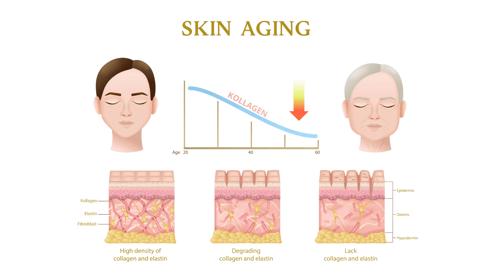 Illustration of skin aging showing declining collagen levels from age 20 to 60, with comparison of youthful high collagen density, midlife collagen degradation, and aged skin with reduced collagen and elastin across epidermis, dermis, and hypodermis layers.