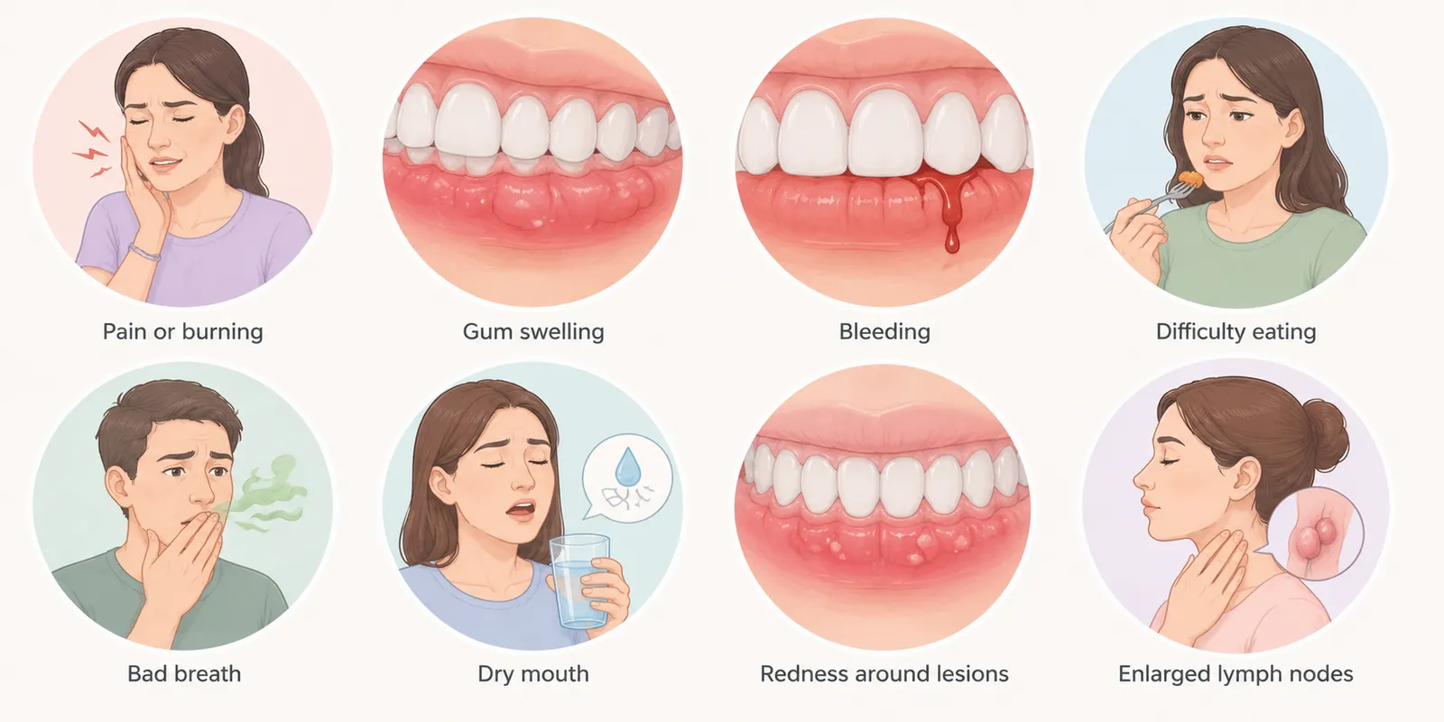 Medical illustration showing symptoms that may accompany White Spots on Gums