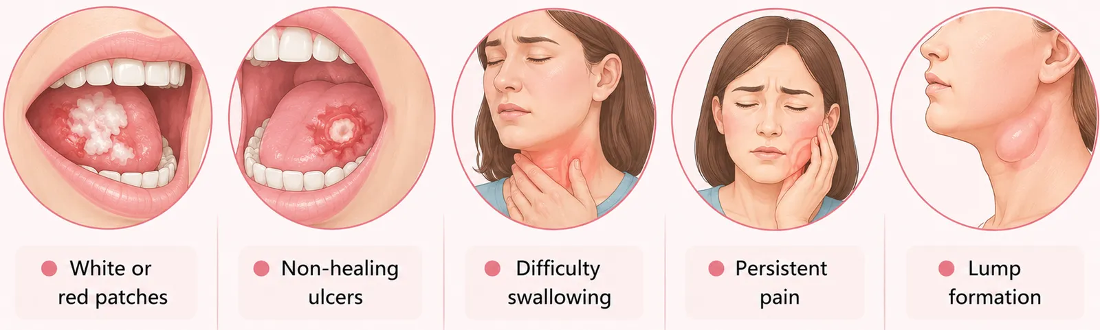 Illustration showing oral cancer warning signs, including persistent white patches, sores, and gum discoloration, explaining Why Are My Gums White Instead of Pink and when to seek dental evaluation.
